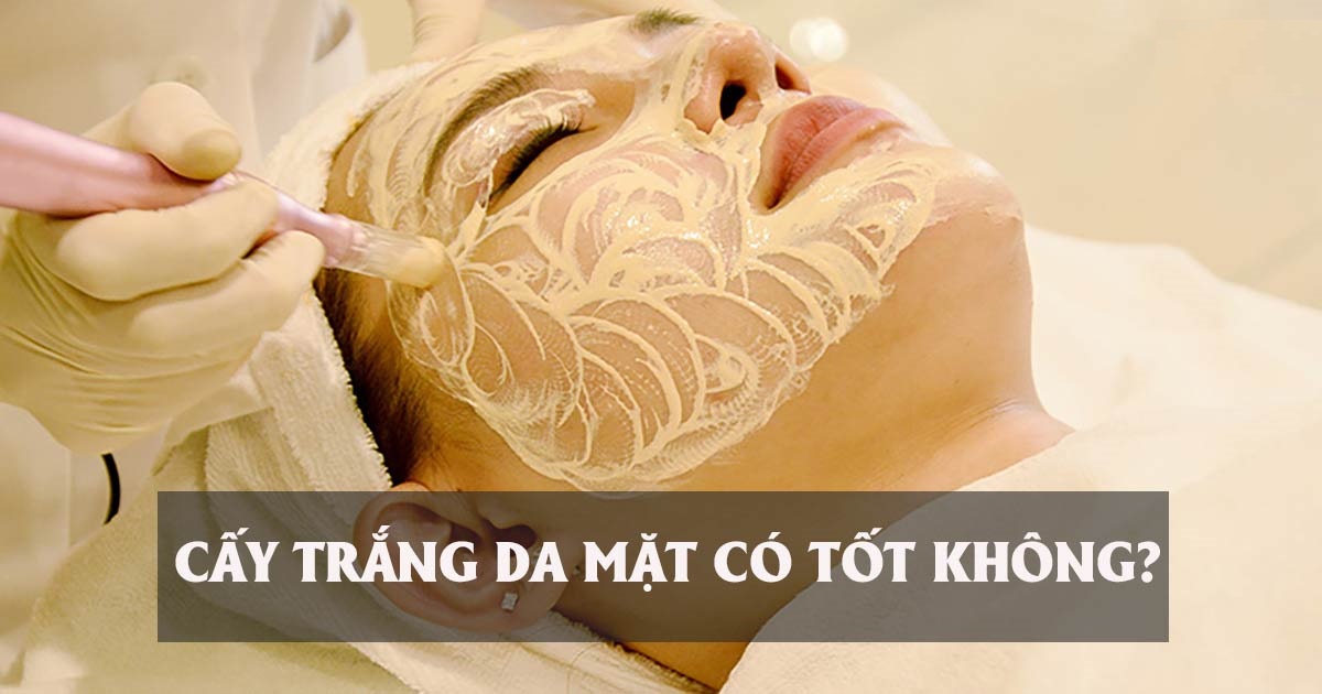 Cấy trắng da mặt có tốt không?