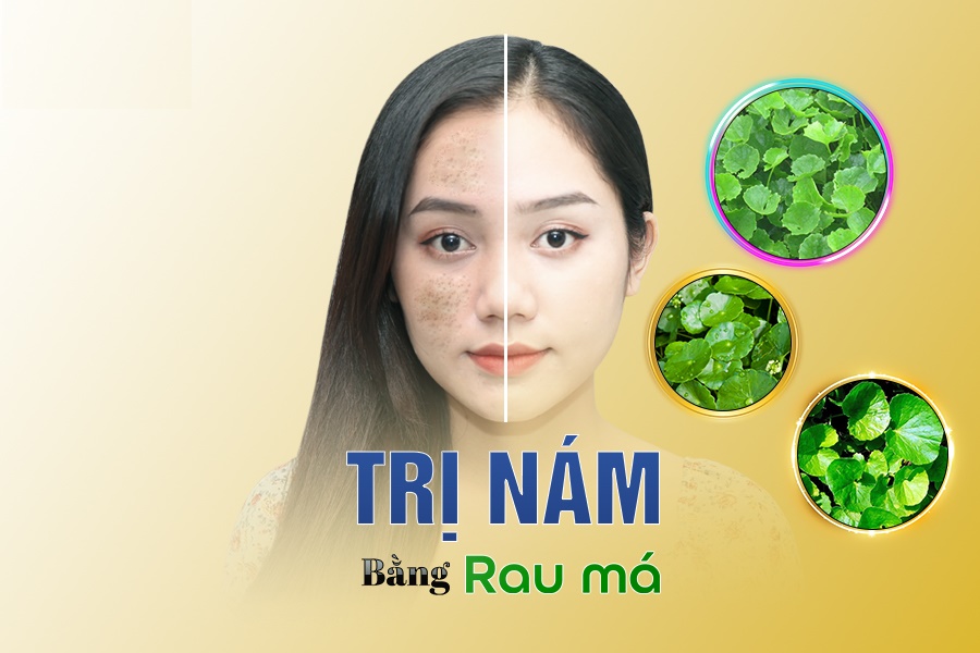 Trị nám bằng rau má