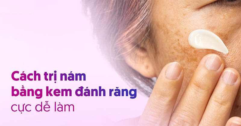 Kem đánh răng có tác dụng loại bỏ nám trên da